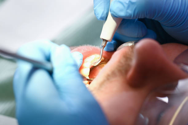Best Emergency Dental Services for Seniors in Sunnyslope, WA
